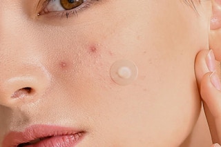 a woman with a pimple patch on her face