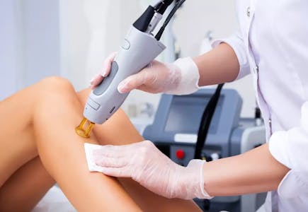 Laser Hair-Removal Sessions