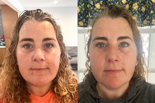 a person before and after using olay products