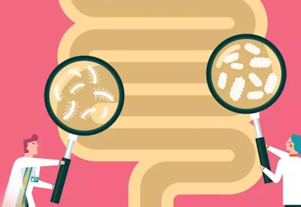 Food Intolerance Test