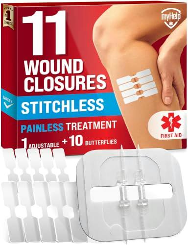 Emergency Wound Closure Strips