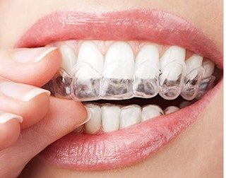 Mouth guard being placed in mouth