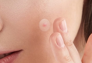 a pimple patch on someone's face