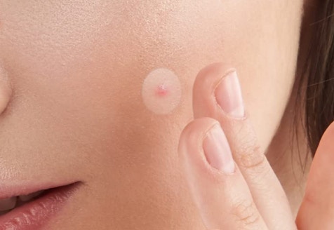 Amazon Acne Pimple Patches 2024