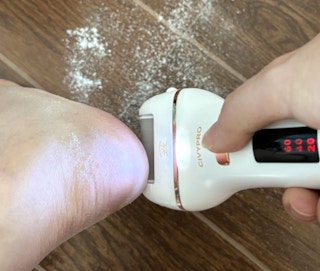 a electric callus remover removing calluses off a foot
