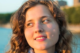 a woman wearing pimple patches