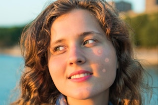 a woman wearing pimple patches