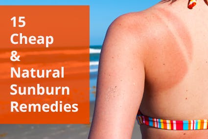 15 Uncommon Sunburn Remedies Your Skin and Wallet Will Love