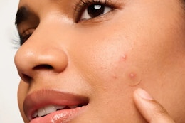 someone with a mighty patch pimple patch on their face 